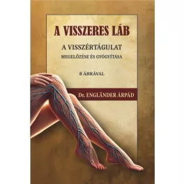   A visszeres láb a visszértágulat megelőzése és gyógyítása